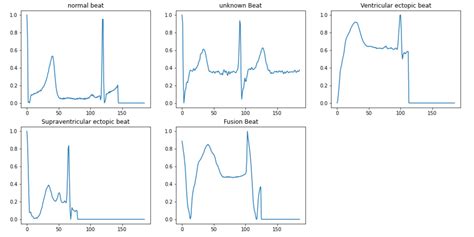 mit-bih ecg compression test database|GitHub .